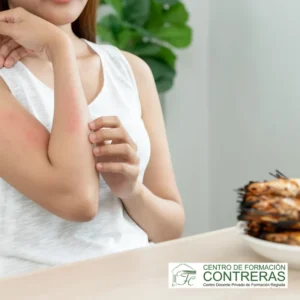 Gestión De Alérgenos En El Sector De La Restauración